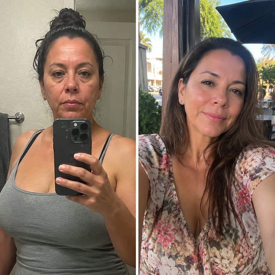 Antes y después